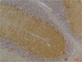 KCNN3 (SK3) antibody