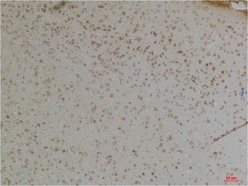 KChIP1 antibody