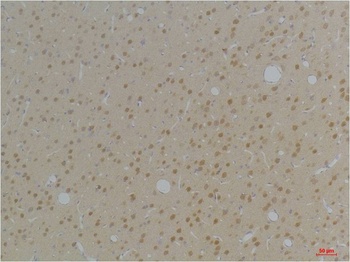 KVβ1 Rabbit pAb