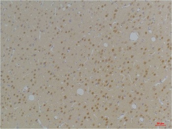 KVbeta1 antibody