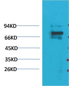 Kv1.5 antibody