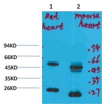 Kv1.8 antibody