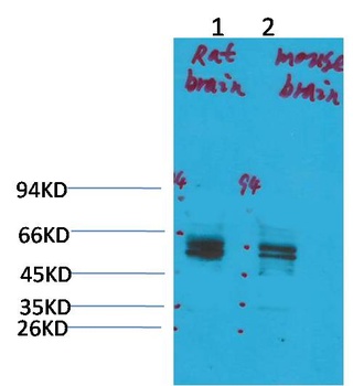 Kv11.1 antibody