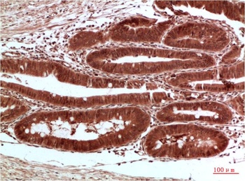 Acetyl-CoA Carboxylase antibody