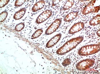HIF-1α Rabbit pAb