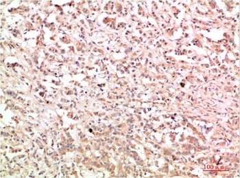 c-Abl antibody