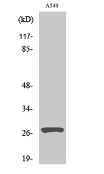 Cleaved-Cathepsin D HC (L169) antibody
