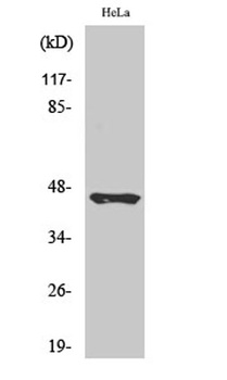 Cleaved-Plasma Kallikrein HC (R390) antibody