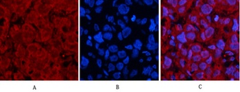 p53 (Di Methyl Lys370) rabbit pAb