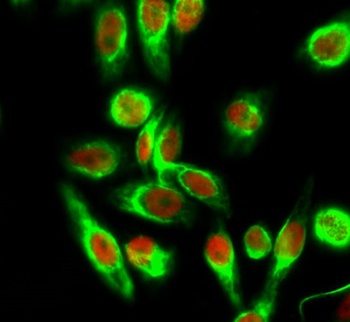 Histone H4 (Acetyl Lys5) antibody