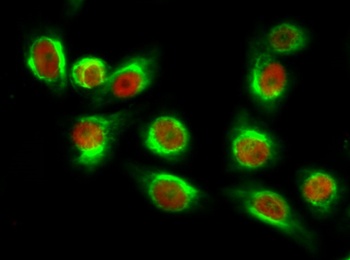 NFκB-p65 (Acetyl Lys310) rabbit pAb
