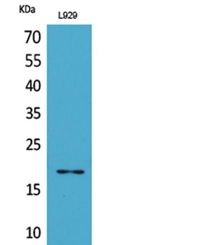 Acetyl eIF5A/eIF5A2 (K47) antibody