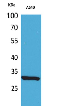 ATF-5 (Acetyl Lys29) rabbit pAb