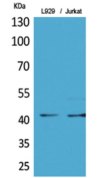 E2F-4 (Acetyl Lys96) antibody
