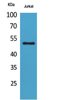 HNF-3alpha/beta/gamma (Acetyl Lys264/253/211) antibody