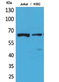 NFκB-p65 (Acetyl Lys218) rabbit pAb