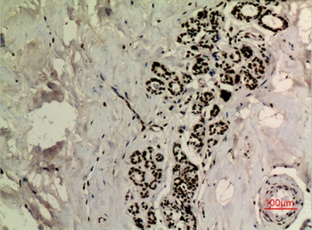 p53 (Acetyl Lys370) rabbit pAb