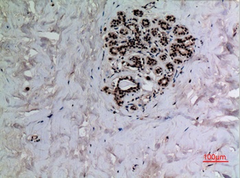 p53 (Acetyl Lys372) rabbit pAb