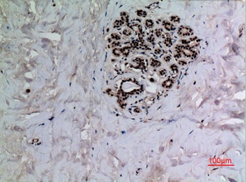 p53 (Acetyl Lys372) antibody