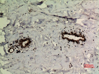 p73 (Acetyl Lys321) rabbit pAb Antibody