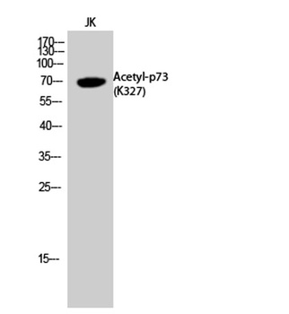 p73 (Acetyl Lys327) rabbit pAb Antibody