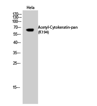 Cytokeratin-pan (Acetyl Lys194) antibody