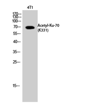 Ku-70 (Acetyl Lys331) rabbit pAb