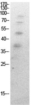 Ub (Acetyl Lys27) antibody