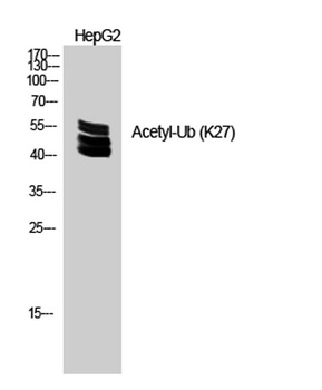 Ub (Acetyl Lys27) rabbit pAb Antibody