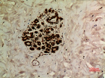 Ub (Acetyl Lys27) rabbit pAb Antibody