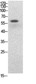 NFκB-p65 (Acetyl Lys314/Lys315) rabbit pAb