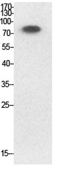 Ub (Acetyl Lys33) antibody