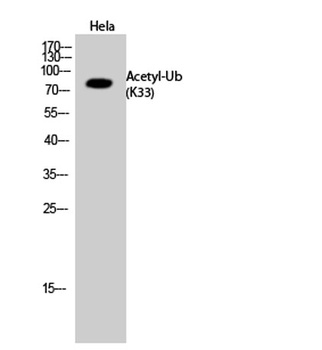 Ub (Acetyl Lys33) rabbit pAb Antibody