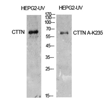 Cortactin (Acetyl Lys235) rabbit pAb Antibody
