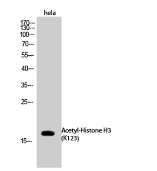 Histone H3 (Acetyl Lys123) antibody