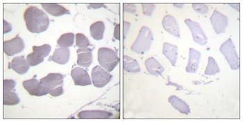 AMPKβ1 (phospho Ser182) rabbit pAb Antibody