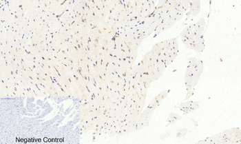 AP-1 (phospho Ser63) rabbit pAb Antibody