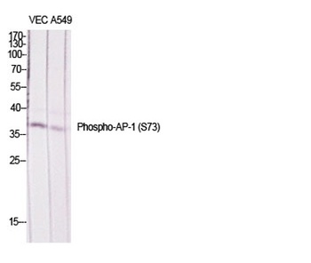 AP-1/Jun D (phospho-Ser73/100) antibody