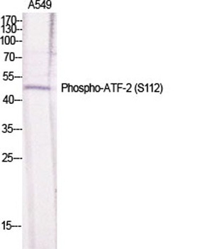 ATF-2 (phospho-Ser112) antibody