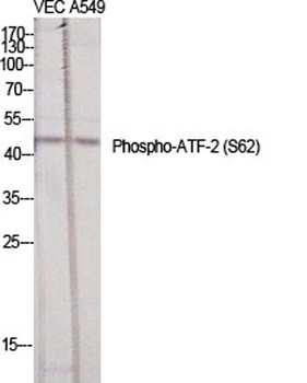 ATF-2 (phospho-Ser62) antibody