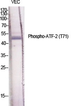 ATF-2 (phospho-Thr71) antibody