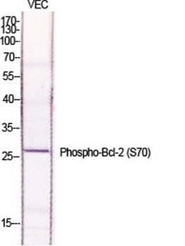 Bcl-2 (phospho-Ser70) antibody