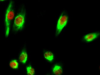 Chk2 (phospho-Thr68) antibody