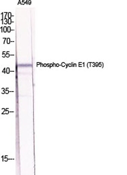 Cyclin E1 (phospho-Thr395) antibody