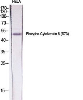 Cytokeratin 8 (phospho-Ser73) antibody