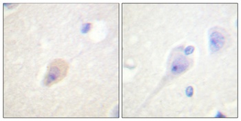 DARPP-32 (phospho Thr75) rabbit pAb Antibody