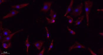 eIF2alpha (phospho-Ser51) antibody