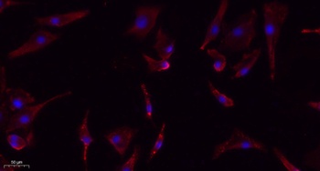 eIF2α (phospho Ser51) rabbit pAb