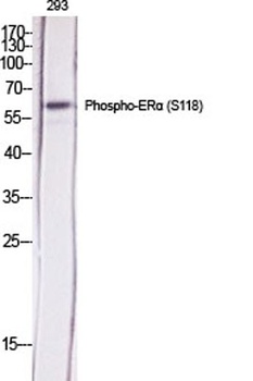 ERalpha (phospho-Ser118) antibody