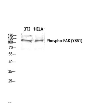 FAK (phospho Tyr861) rabbit pAb Antibody